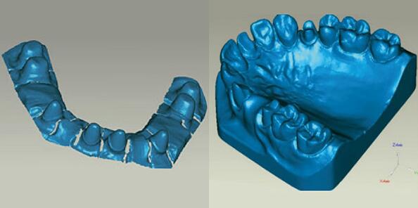 上海抄数服务公司提供的口腔抄数服务
